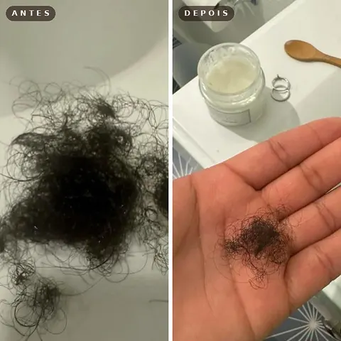 Antes e depois de uma cliente da Consulta de Tricologia Integrativa